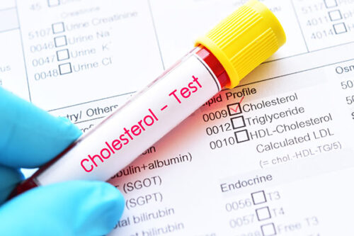 Cholesterol – When and How to Treat It