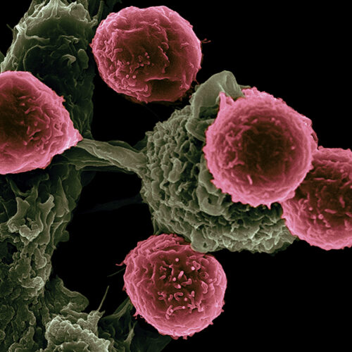 Early Detection for Cancer Is a Risky Business
