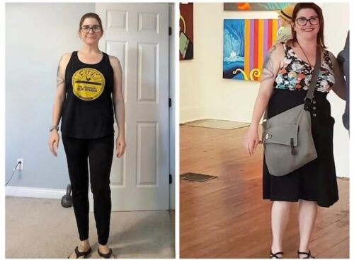 Emily B. Successfully Overcame Rheumatoid Arthritis Following the Starch Solution