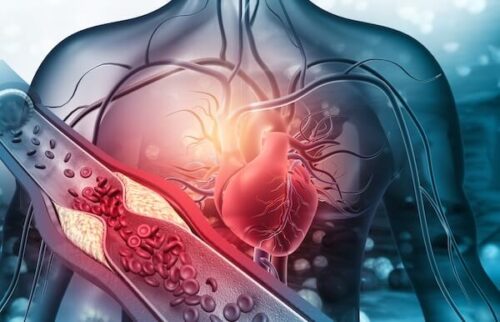 John McDougall, MD: Heart Disease (Full Lecture)